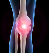 Image_1l_Pain_In_The_Knee