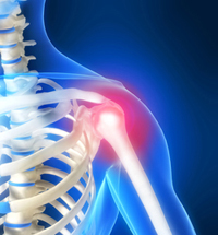 Image_1l_Shoulder_Pain